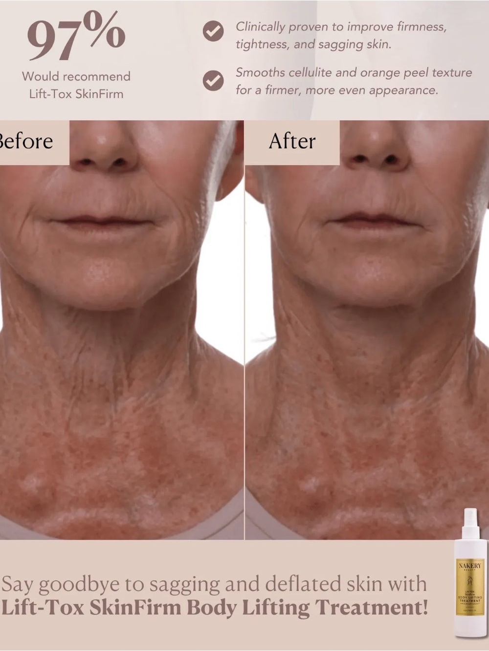 Nakery Beauty White & Gold Body Lifting Treatment Spray - Picture 3 of 5